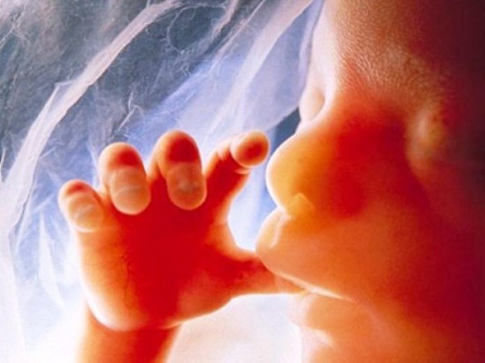 Imagem de um feto